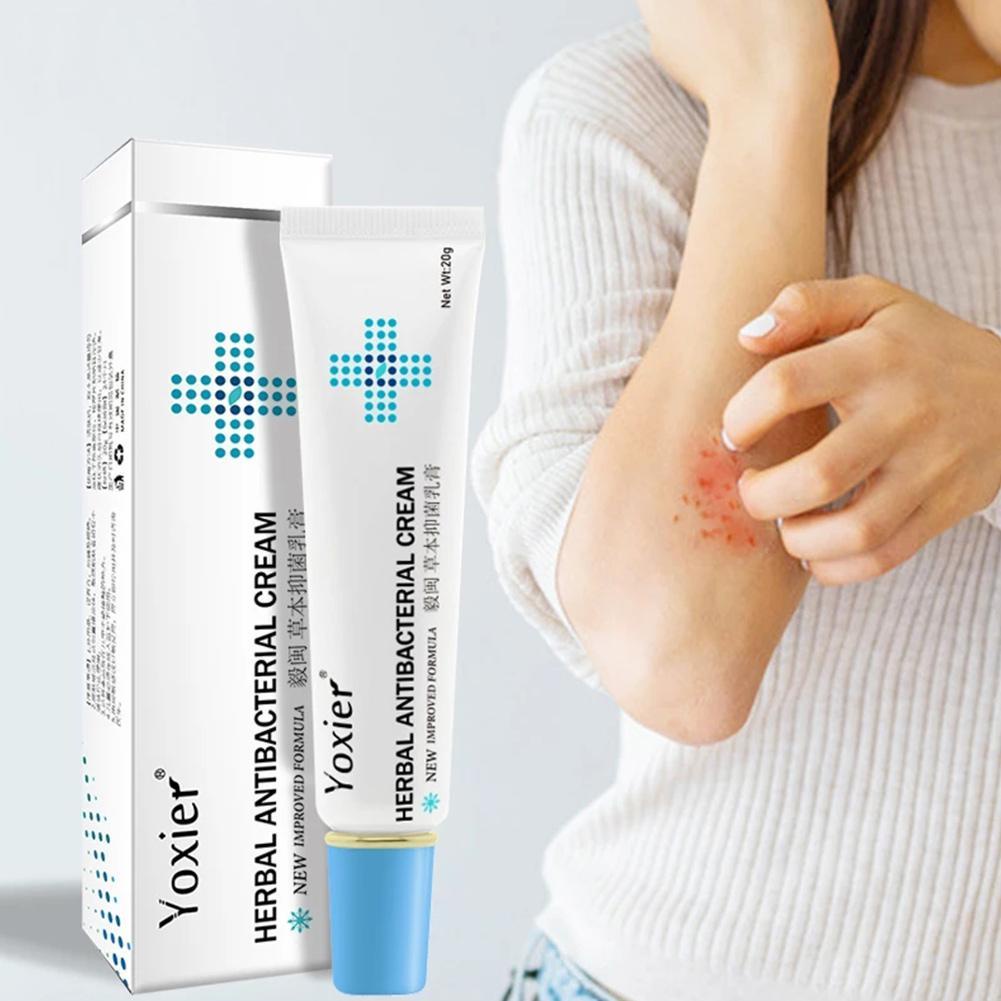 Original Yoxier 20g Herbal Cream Anti Eksim Psoriasis Gatal2