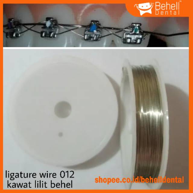 ligature wire 012 untuk kawat lilit behel 1 METER