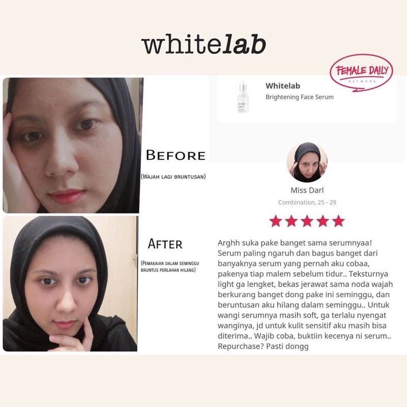 Whitelab Brightening Face Serum 20ML - Niacinamide 10%