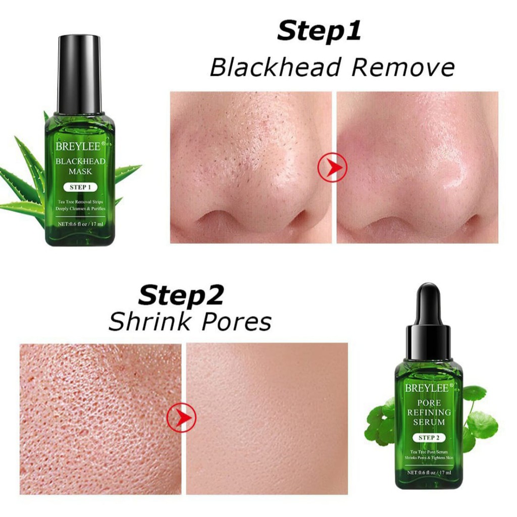 Breylee Pengangkat Komedo Breylee Step 1 Blackhead Masker Breylee Step 2 Pore Minimizer Serum