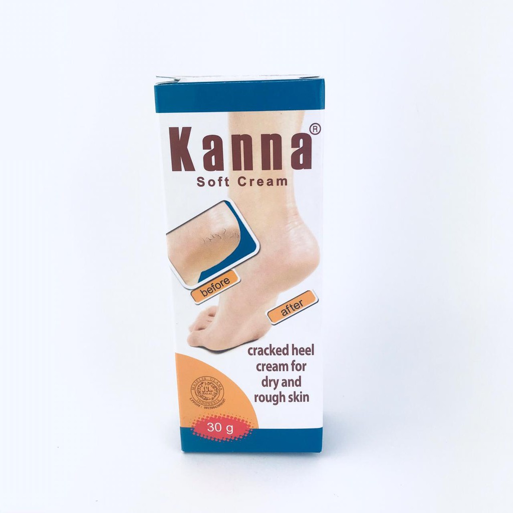 Kanna Soft Cream / Krim kaki / Krim Kulit Siku dan Lutut / 30g