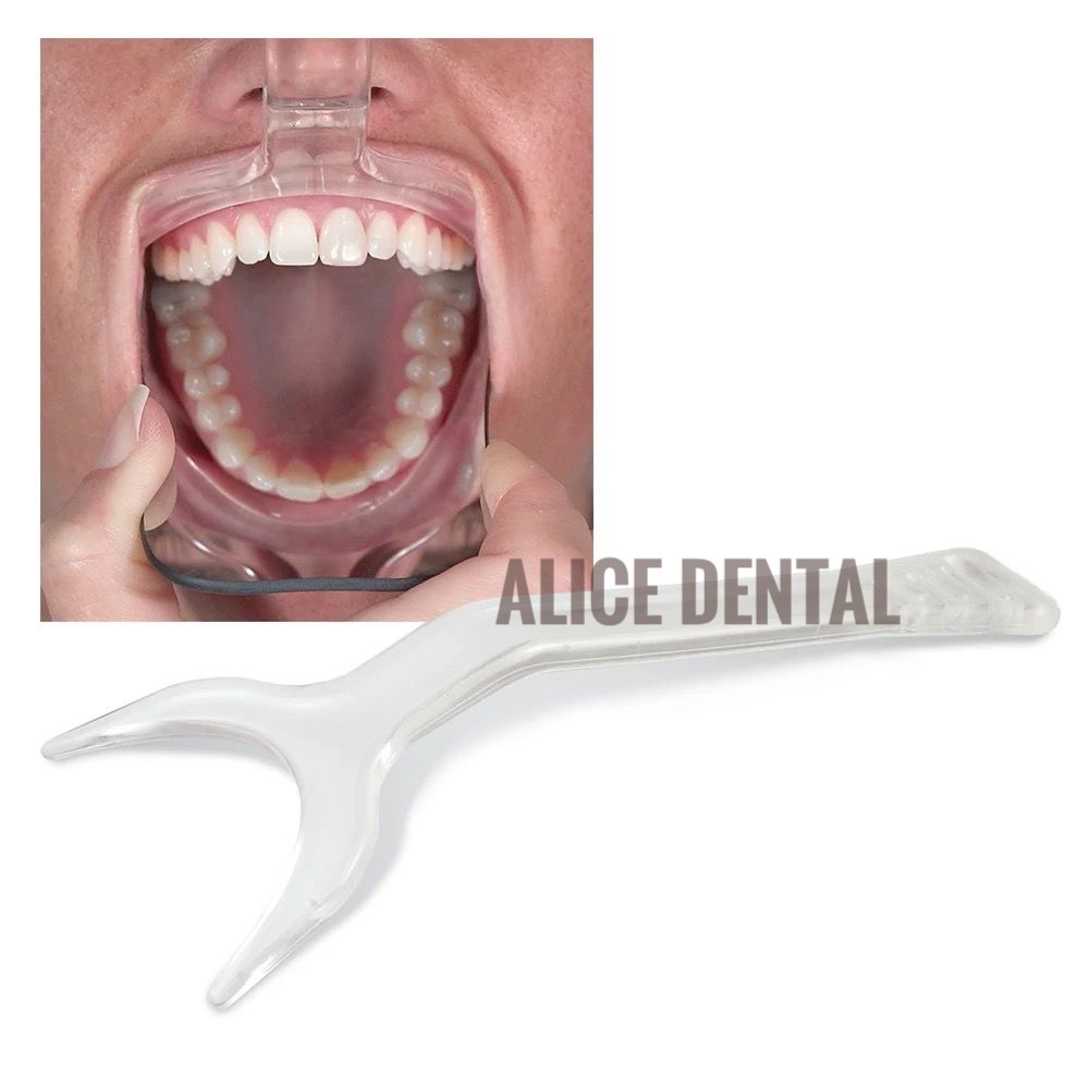 BUCCAL RETRACTOR bucal oklusal occlusal retraktor dental photography cheek retractor tongue spatle penahan lidah spatel spatula depressor sudip lidah gigi