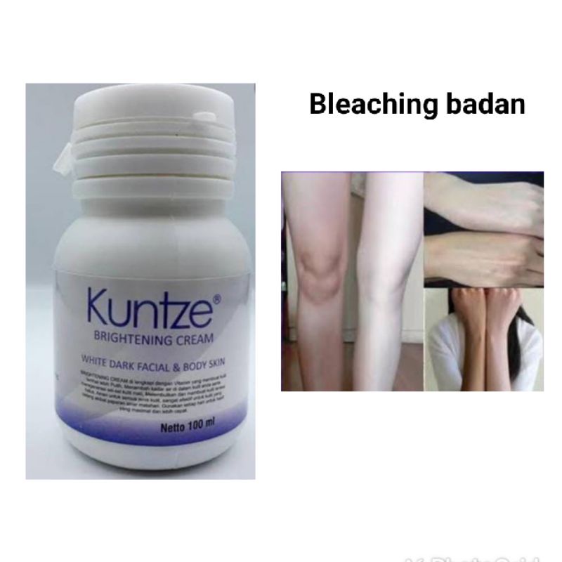 KUNTZE BLEACHING BRIGHTENING CREAM WITH DARK FACIAL &amp; BODY SKIN