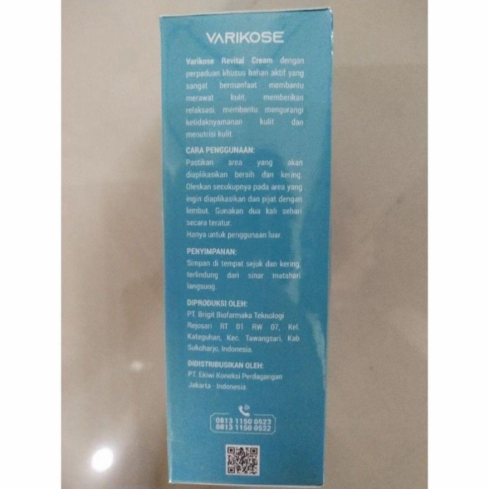 Varicoză edem picioare