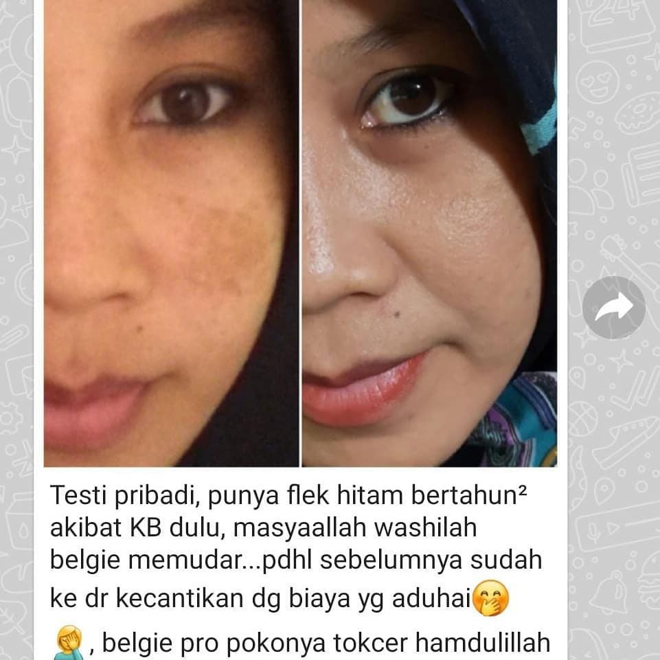 BELGIE PRO SERUM + FACIAL WASH ANTI AGING SKINCARE EROPA TOUCH PEMBERSIH WAJAH  DENGAN EKSTRAK PROPOLIS