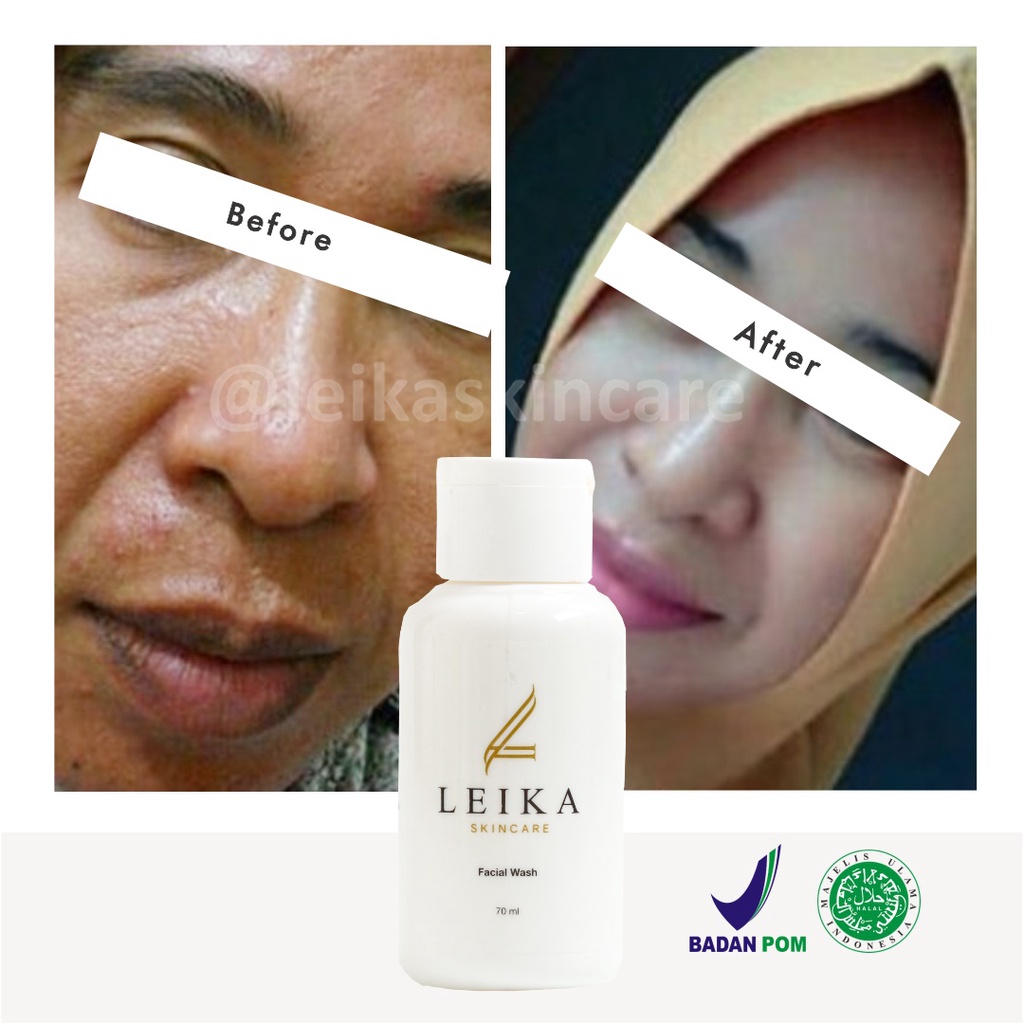 Wow! Sabun Muka Anti Aging Paling Ampuh Sabun Anti Penuaan Dini Asli Halal BPOM Facial Wash Leika Skincare 70ml Sabun Penghilang Kerutan di Wajah Original