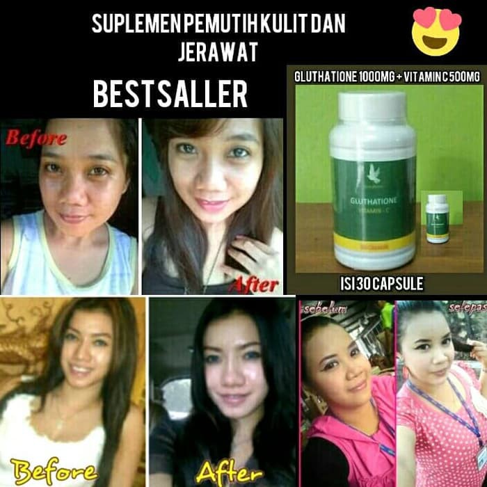 Penghilang Bekas Jerawat - Serum Vege Original - Theraskin Acne Cream Gluthatione / Suplemen Pemutih