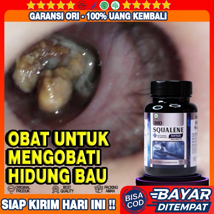 Obat Hidung Bau Busuk - Ingus Bau Busuk - Hidung Meler Berbau Busuk - Obat Hidung Berbau Tak Sedap -