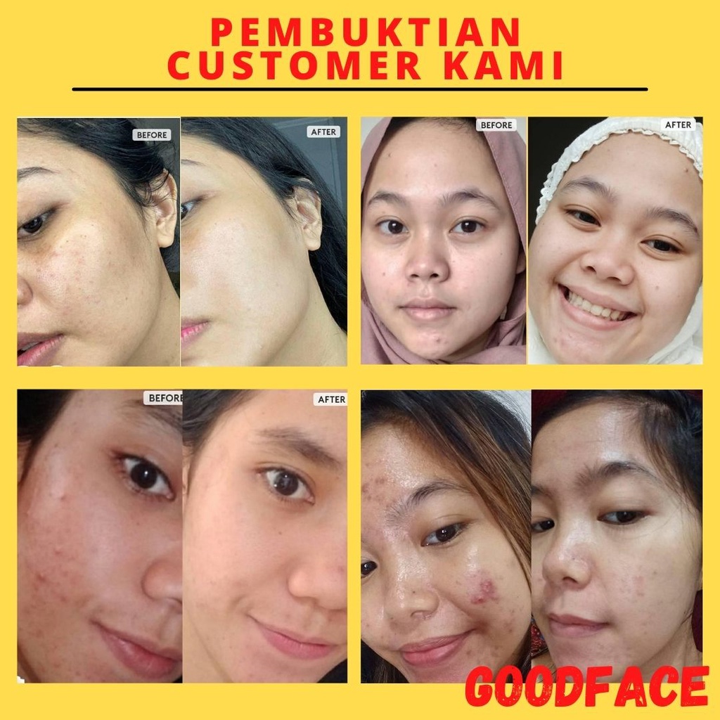 PENGHILANG KERUTAN WAJAH RETINOL SERUM SOMETHINC 1% PURE RETINOL + SQUALANE