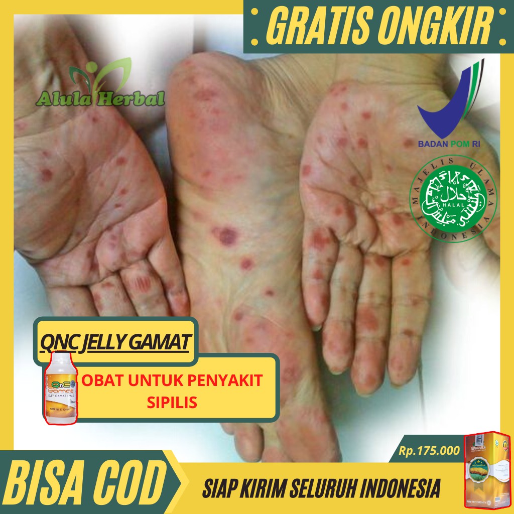 Obat Sipilis Raja Singa Gatal Kelamin Pria Wanita Ampuh Herbal Jelly Gamat Qnc Asli Izin Bpom Shopee Indonesia