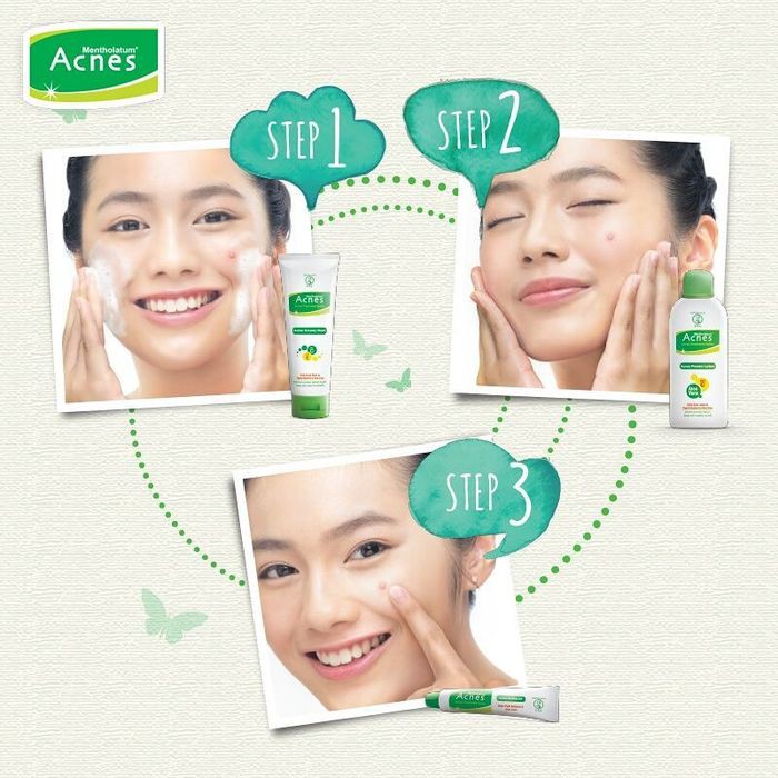 ✿ELYSABETHME✿ (3in1)  Acnes starter pack paket basmi jerawat acne totol jerawat cream sabun travel size