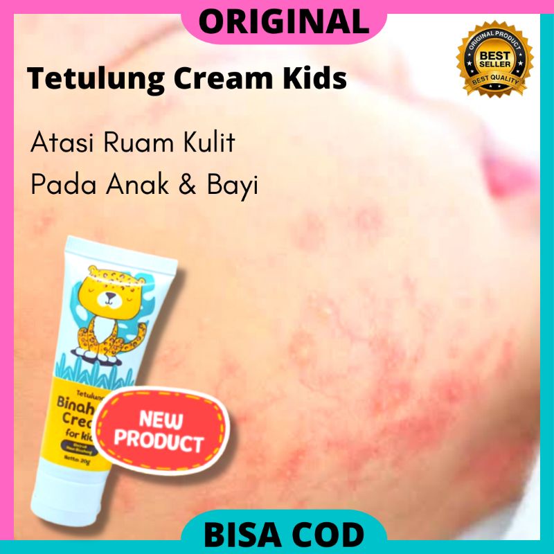 Binahong Kids Ori - Salep Ruam Kulit dan Ruam ASI untuk Bayi Balita Anak Anak BPOM , Cream Lotion Un