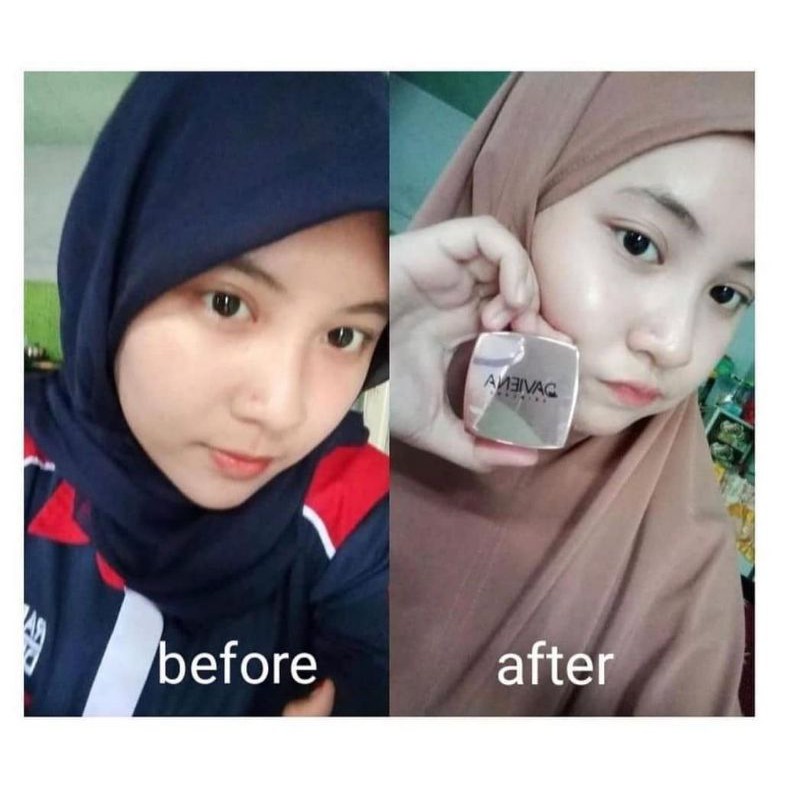 (DAVIENA OFFICIAL)DAVIENA SKINCARE|GLOWING SERIES|PEMUTIH WAJAH BPOM|SKINCARE|DAVINA SKINCARE