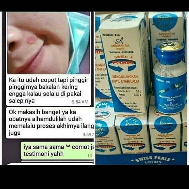 COD PENGHILANG TAILALAT,KUTIL SWISS PARIS BPOM AMPUH/TERLARIS/TERMURAH/FLASH SALE/MURAH LEBAY