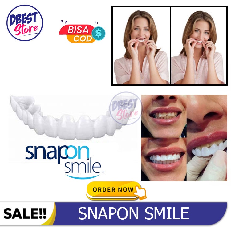 [ COD ] ORIGINAL 100% SNAP ON SMILE AUTHENTIC / GIGI PALSU SEPASANG ATAS BAWAH