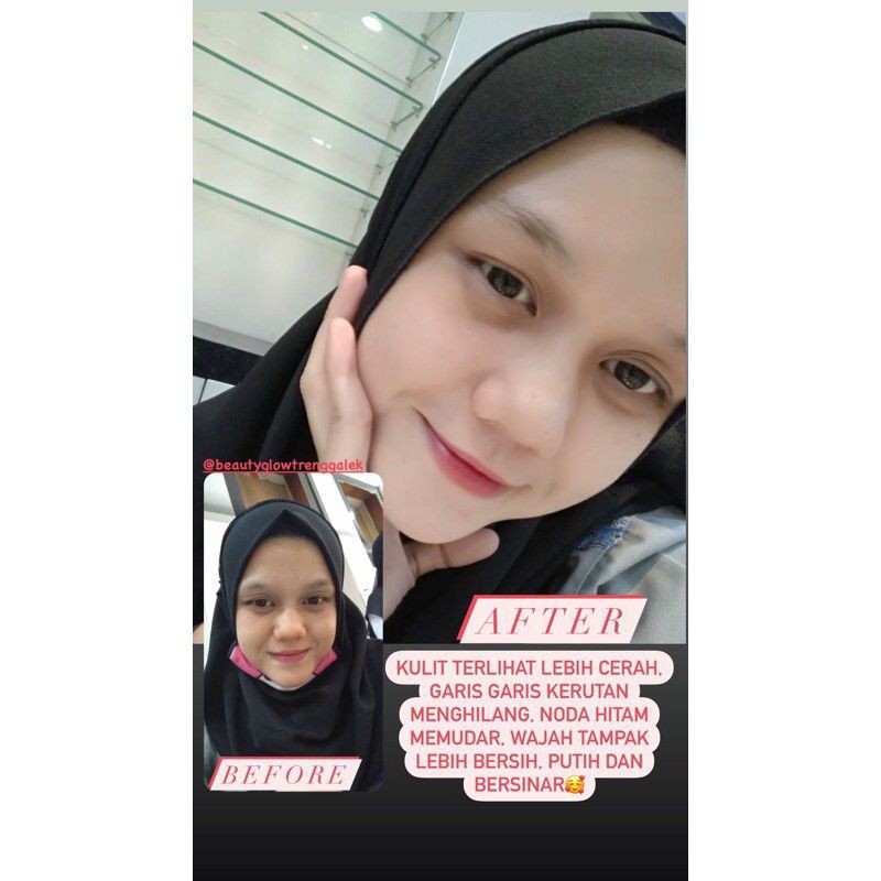 Beauty Glow Whitening Luxury