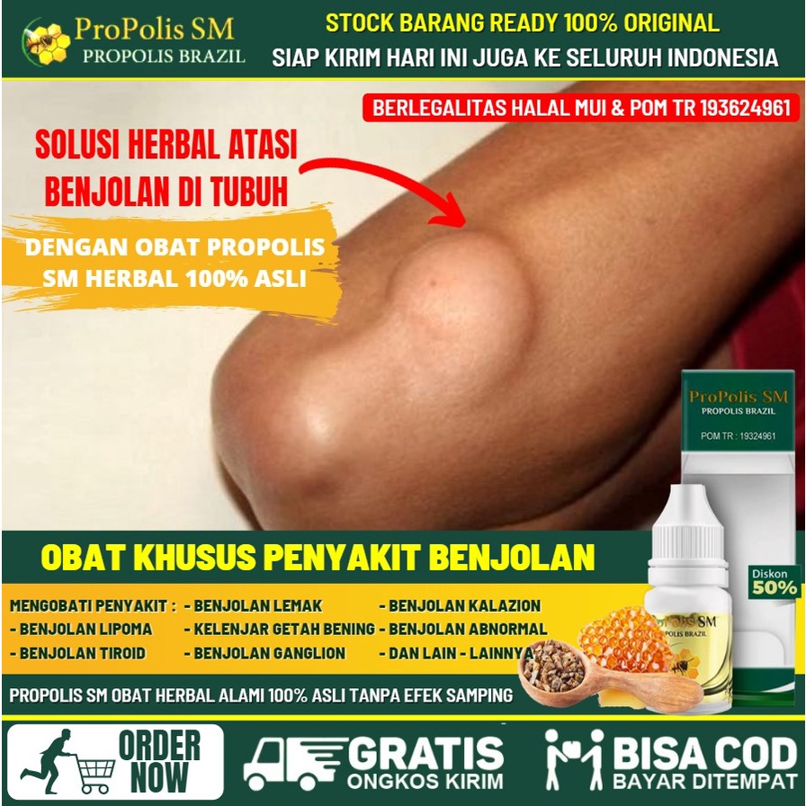 Obat Benjolan Herbal, Obat Oles Penghilang Lipoma, Obat Benjolan Lipoma, Obat Benjolan Lipoma di Tan