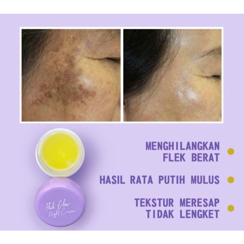 CREAM FLEK AMPUH farmasi /cream flek anti gagal
