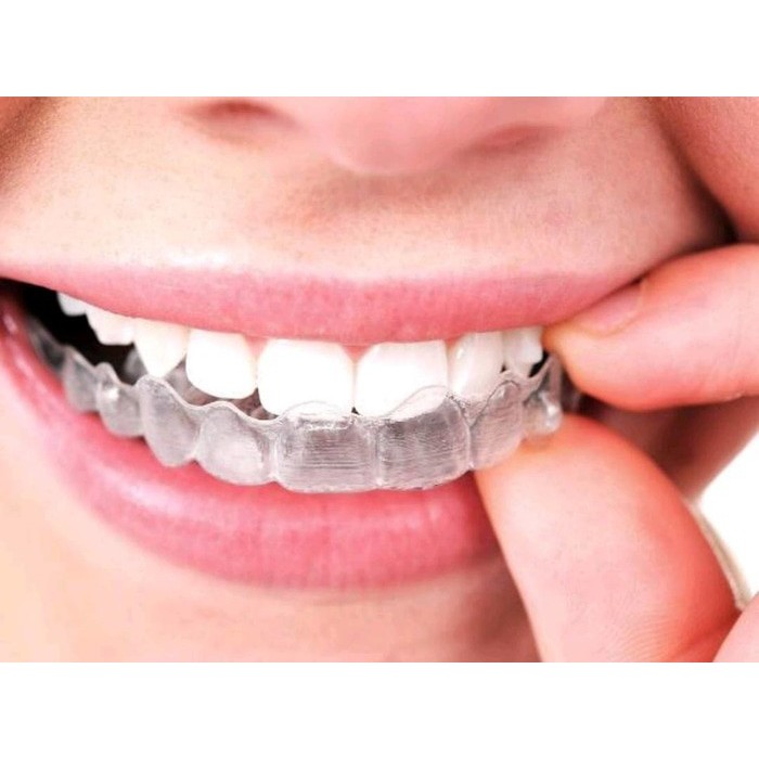 Bahan retainer plastik