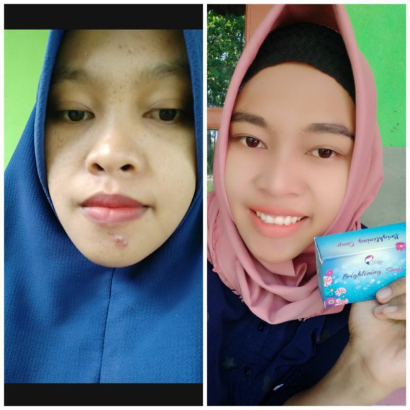 Sabun Kedas Beauty Original BPOM-5
