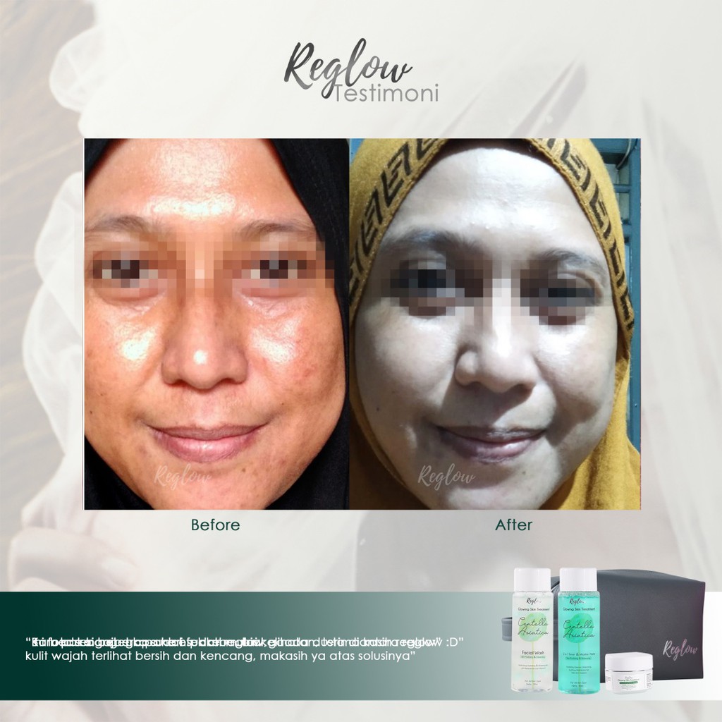 Paket Reglow Glowing Skin Treatment 100 Original Bpom Reglow Official Product Re Glow Shopee Indonesia