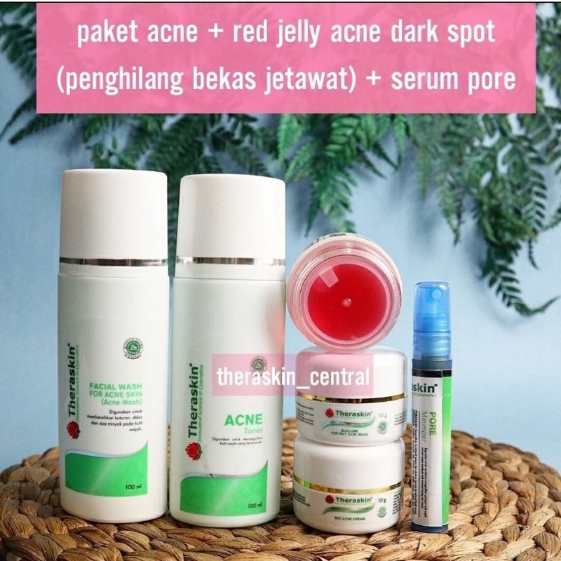 PAKET PENGHILANG JERAWAT RINGAN & MERADANG + PENGHILANG BEKAS JERAWAT + PENGECIL PORE ( BOPENG)