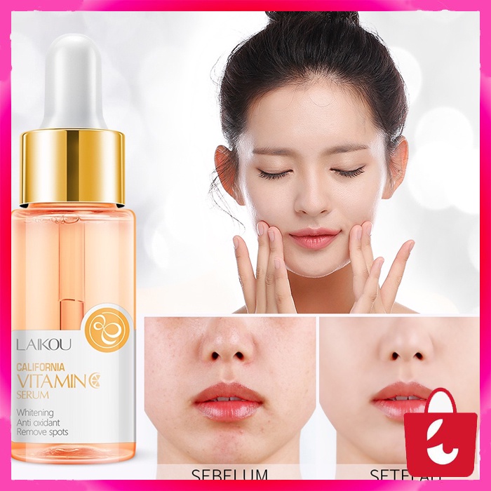 [BISA COD] LAIKOU Serum Vitamin C Essence Berpijar Mengurangi Kulit Kusam Memudarkan Kehitaman