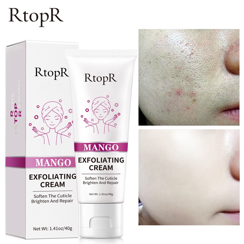 RtopR MANGO Exfoliating Cream Skin Care Whitening Moisturizer Repair Facial Scrub Skin Cleaner Acne Blackhead Treatment Remove Face gel(40g)