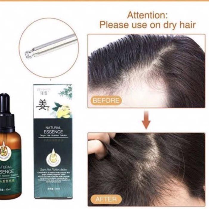 ◊ SERUM PENUMBUH RAMBUT BOTAK PENUMBUH BREWOK PENUMBUH ALIS CEPAT ◙