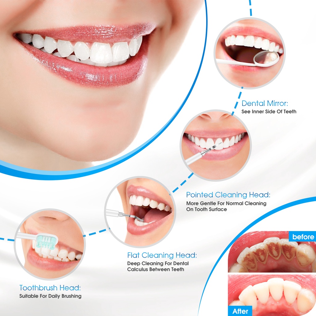 Alat Pembersih Karang Gigi Dental Scaling Sonic Elektrik 1 Set 2 Modes Perawatan Dan Pembersih Karang Gigi Dental Remover With Light