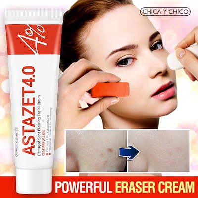 CHICA Y CHICO ASTAZET 4.0