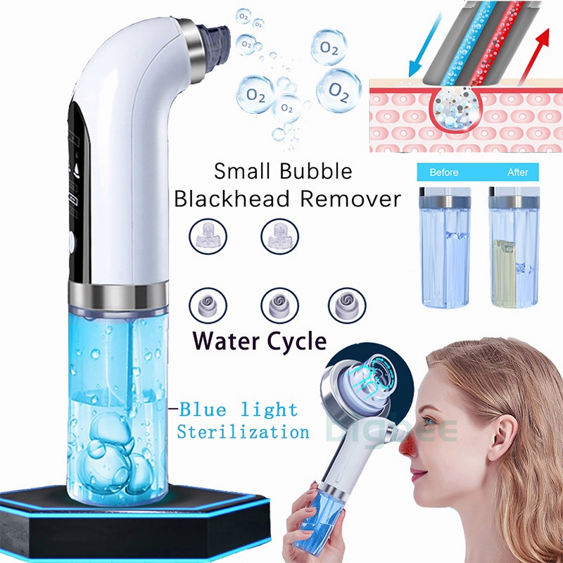 Alat Penyedot Komedo Sirkulasi Air /Vacuum Pori Blackhead Cleaner Rechargeable