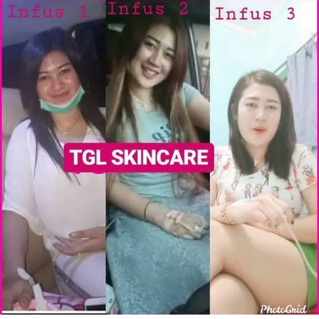 Infus whitening racikan dokter yang ampuh memutihkan seluruh badan 2-7hari setelah infus