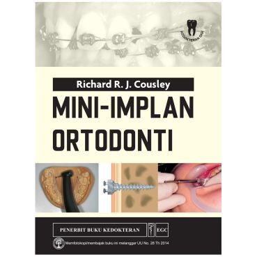 Buku Mini-Implan Ortodonti