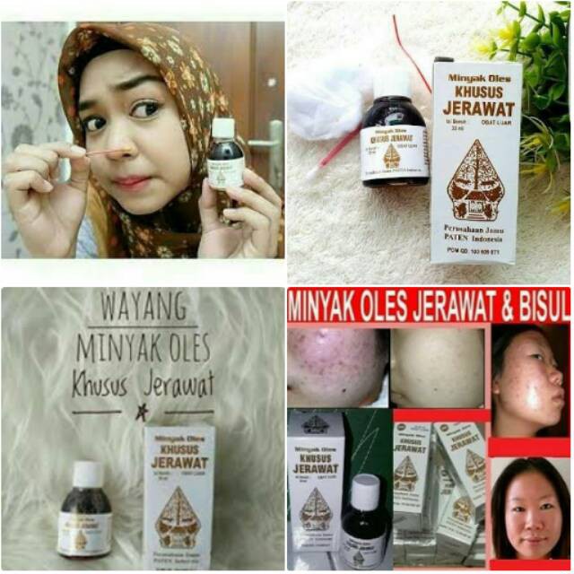 

MINYAK JERAWAT WAYANG JERAWAT BPOM OBAT JERAWAT WAYANG BPOM