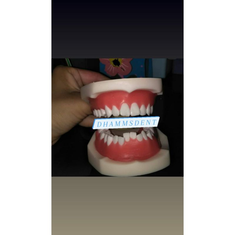 Model Studi Gigi Ortho Typodont