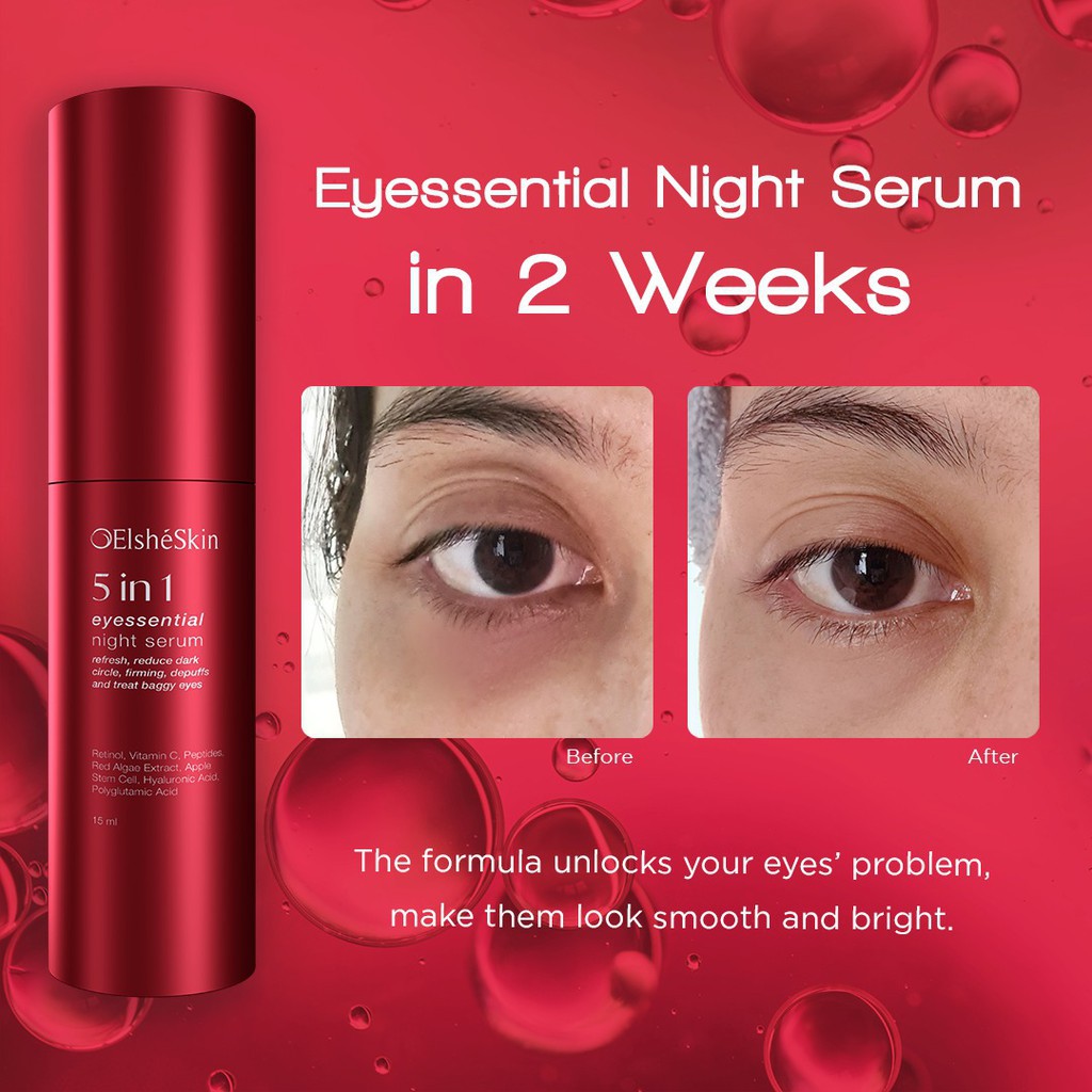 Elsheskin 5 in 1 Eyessential Night Serum Perawatan Mata - BOTOL MERAH