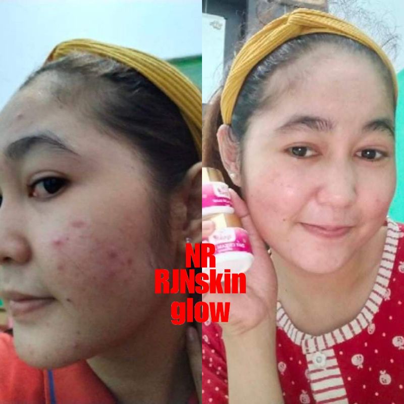 CREAM BPOM PEMUTIH WAJAH AMPUH NRGLOW/NR RJNSKINGLOW CREAM GLOWING TERLARIS