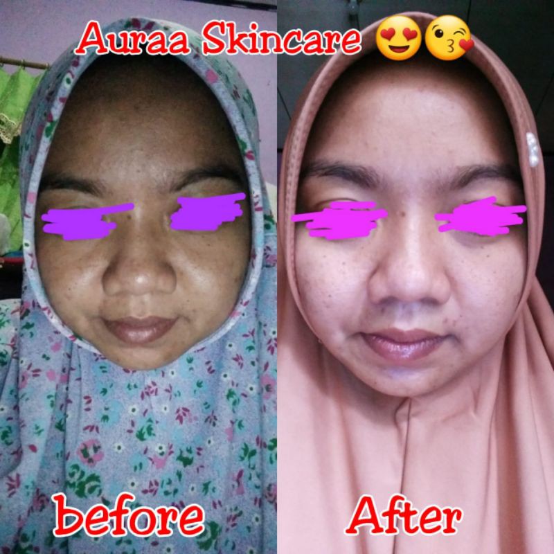 aura Skincare