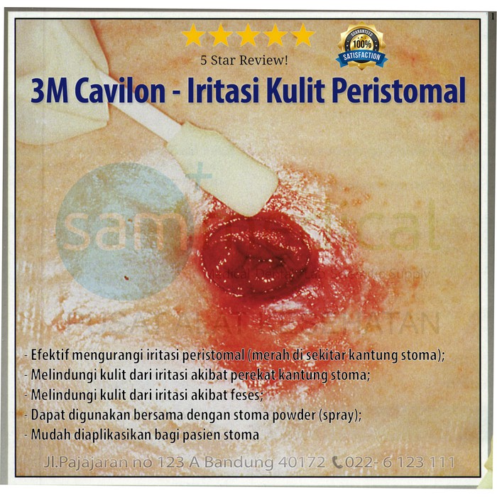3M CAVILON FILM 3 ML WAND 3345
