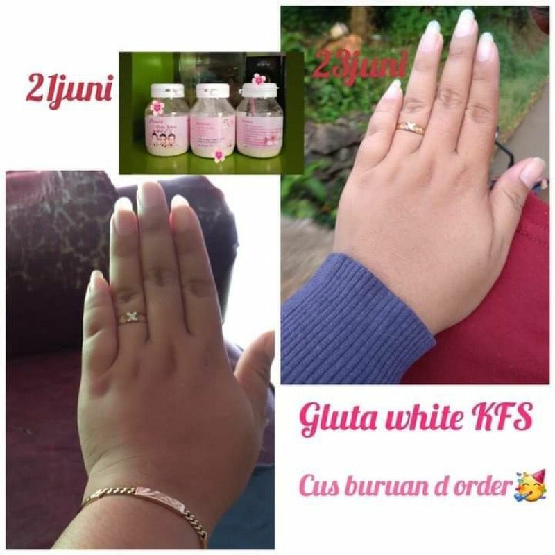 [ORIGINAL] GLUTA WHITE KFS SUSU COLLAGEN PEMUTIH