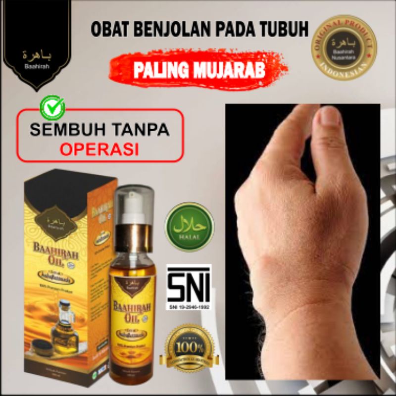 [BAAHIRAH OIL] Minyak Oleh Dengan Sejuta Manfaat dari BAAHIRA