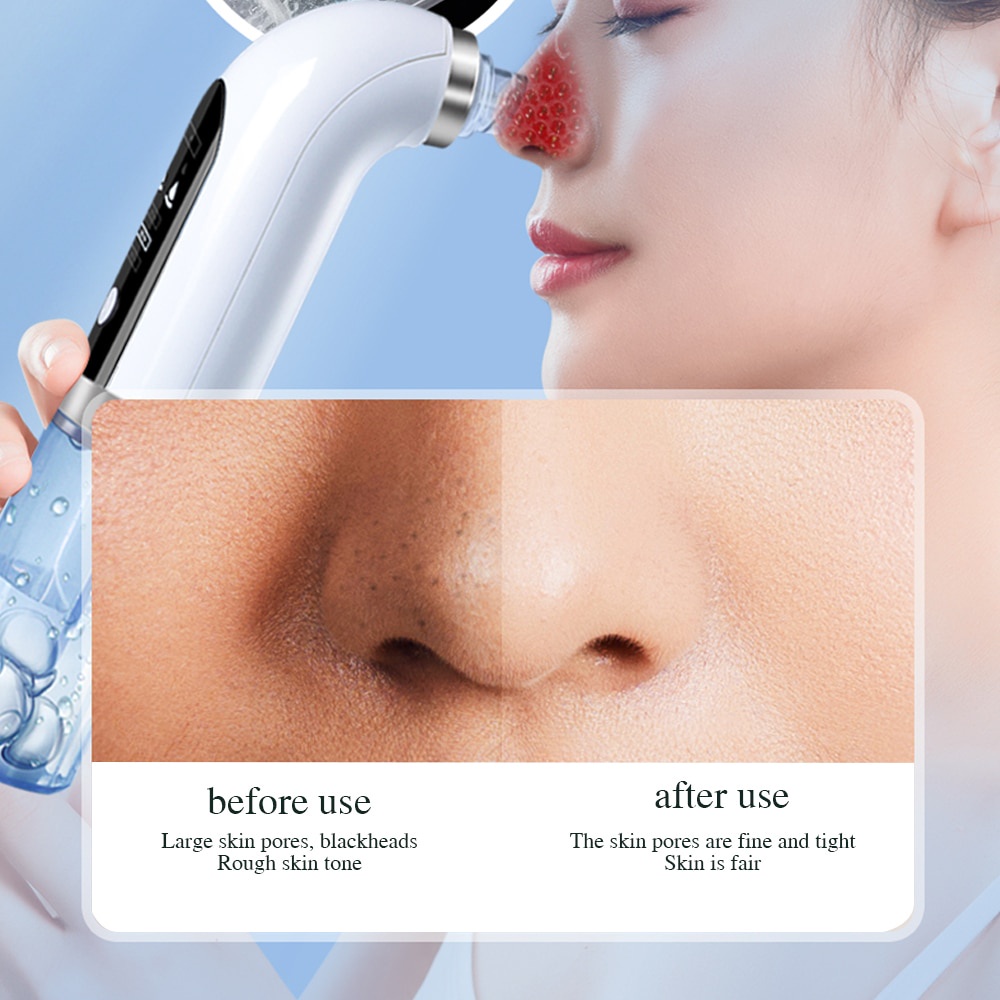 SaLorie Blackhead Remover Pore Vacuum Cleaner Upgraded Blackhead Vacuum Rechargeable Face Vacuum Comedone Extractor Tool for Blackhead D00161