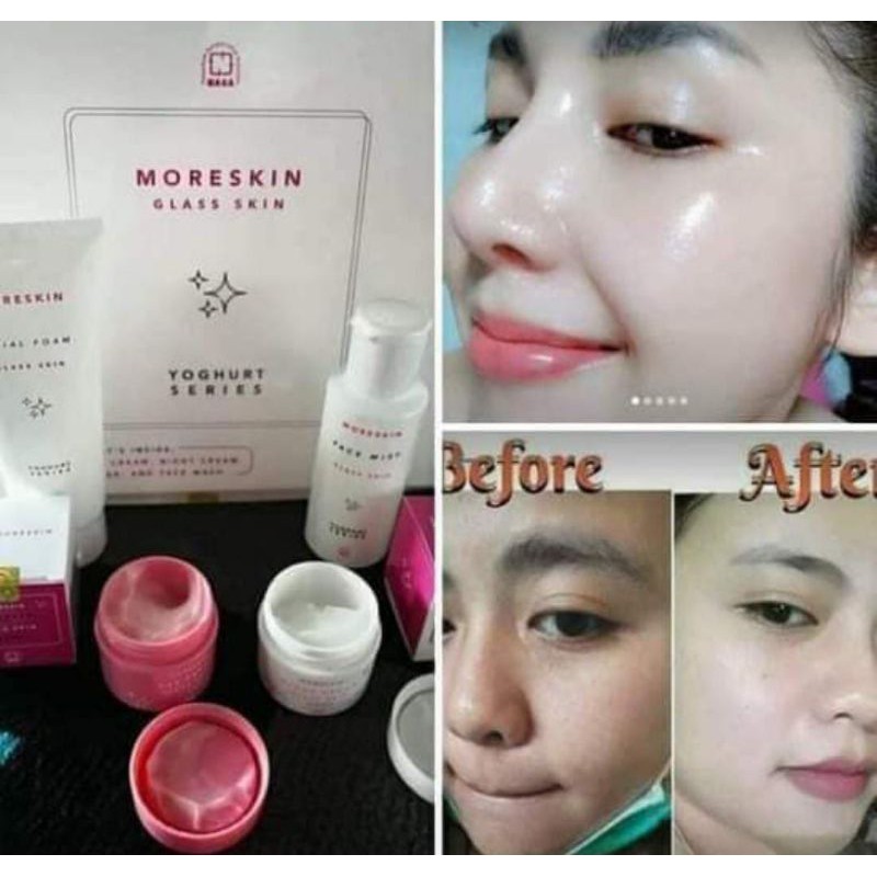 

moreskinglasskinseries