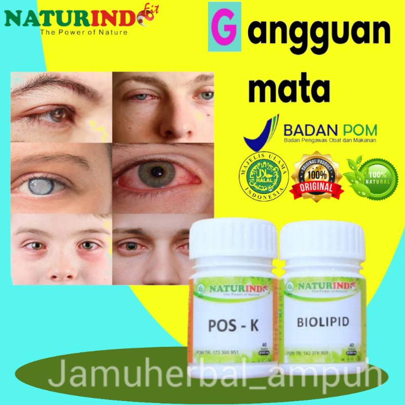 

NI Obat masalah gangguan mata penyakit mata glukoma katarak kunjungtivitis mata merah NATURINDO herbal