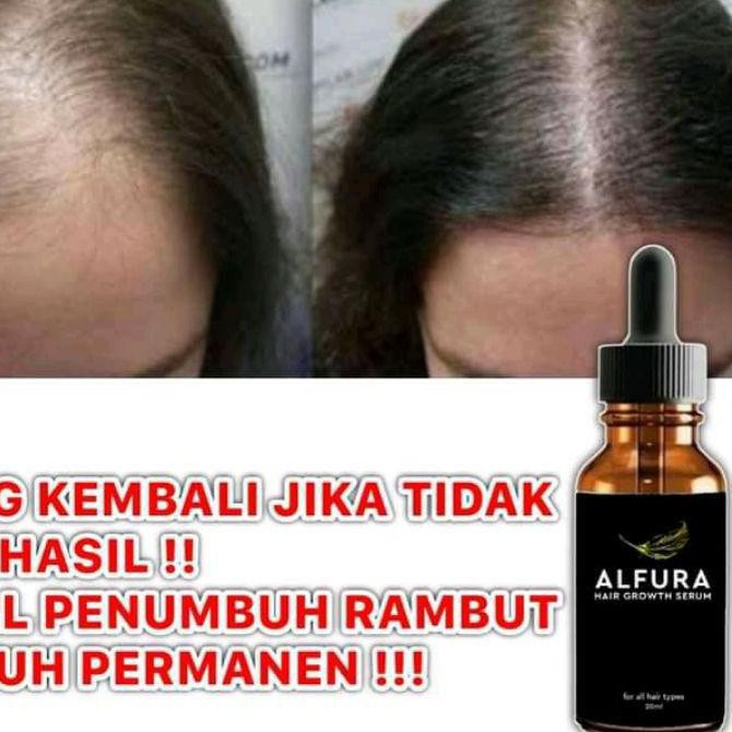 ✥ ALFURA SERUM PENUMBUH RAMBUT TERBAIK ☄