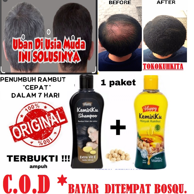 &quot;PROMO*HAPPY&quot;PAKET SHAMPO &amp; MINYAK KEMIRIKU PENGHILANG UBAN 100% ORIGINAL BPOM-C.O.D-MURAH