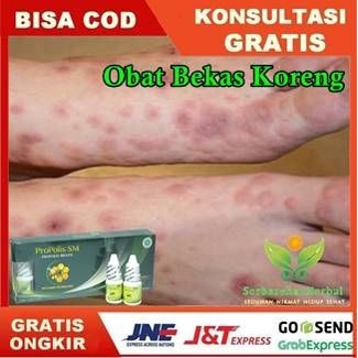 [MURAH] [ COD] Obat Herbal Bekas Korengan,penghilang bekas luka koreng, Propolis SM