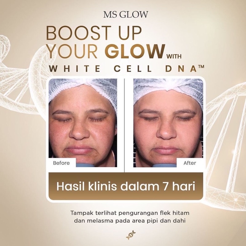 [NEW] MS GLOW White Cell DNA Paket Wajah Free Pouch / Bonus Totebag Terbaru