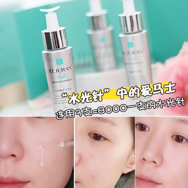 REJURAN Turnover Ampoule